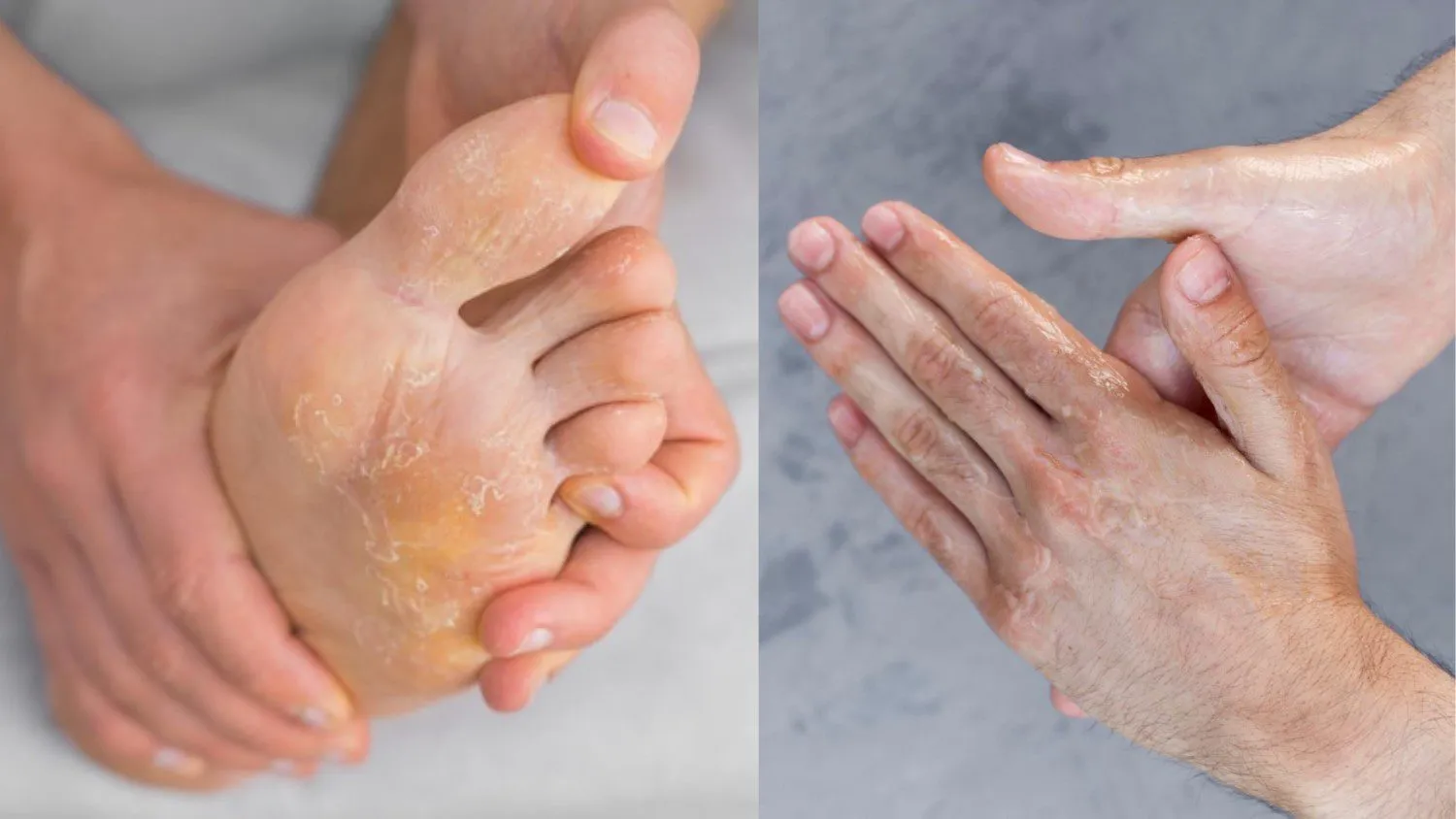 Patient Skin Care